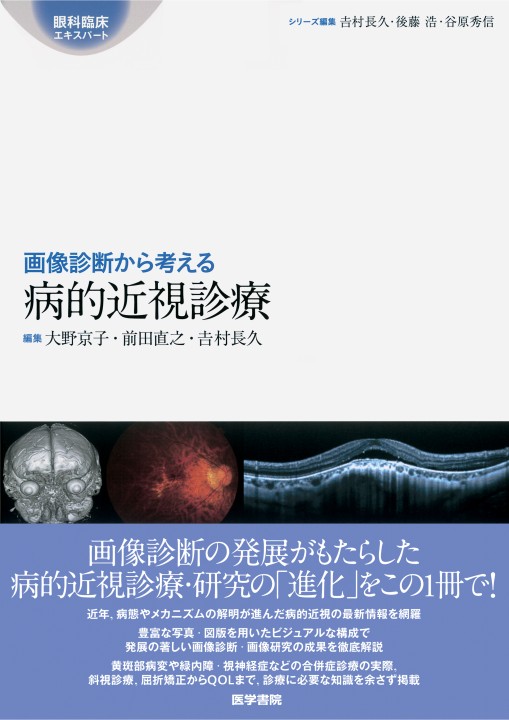 眼科診療エキスパート 画像診断から考える 病的近視診療 立ち読み