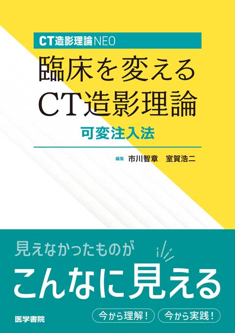 臨床を変えるCT造影理論 可変注入法　