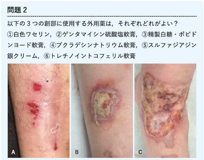 医学界新聞プラス［第4回］皮膚潰瘍治療薬の選びかた・使いかた――どの
