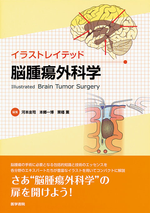 イラストレイテッド 脳腫瘍外科学