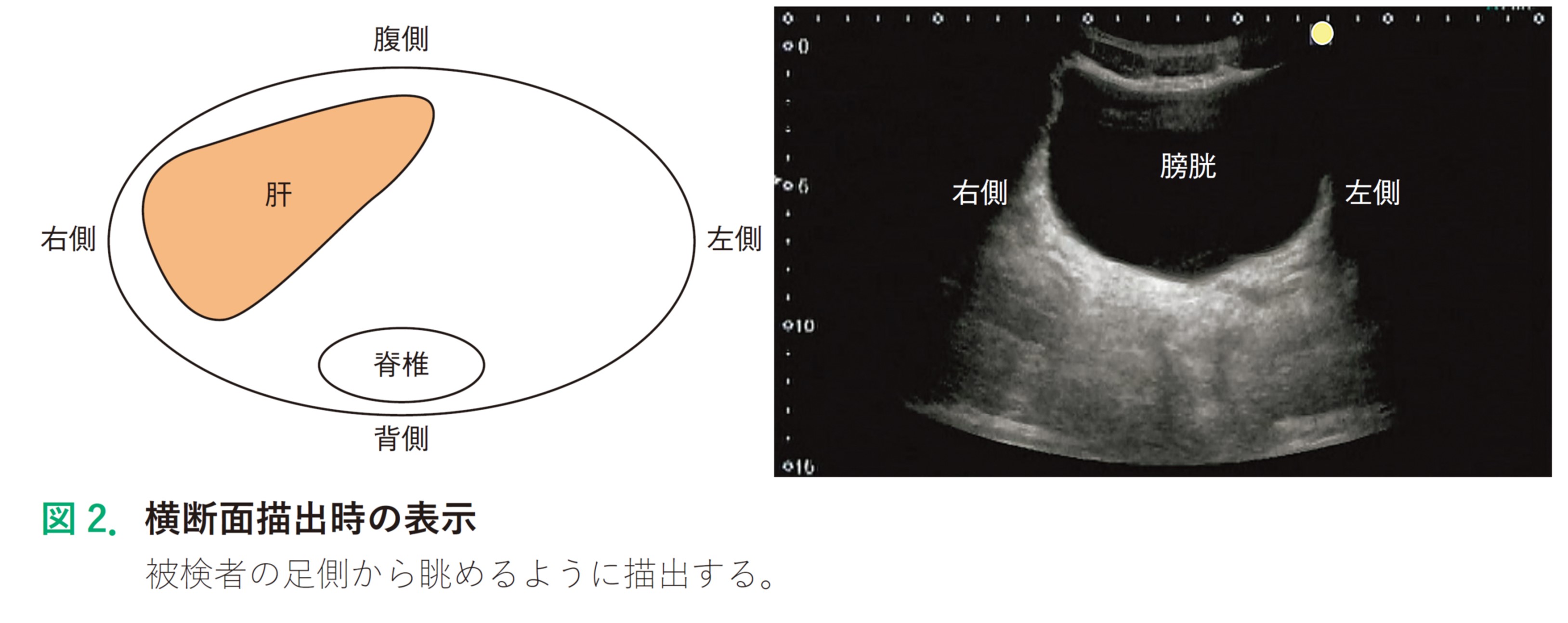 図2.jpg