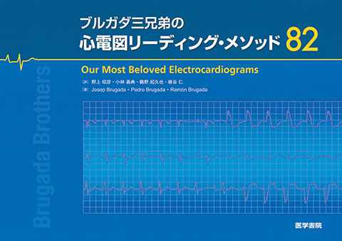 ブルガダ三兄弟の心電図リーディング・メソッド82