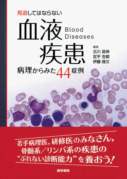 見逃してはならない血液疾患　病理からみた44症例