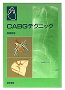CABGテクニック