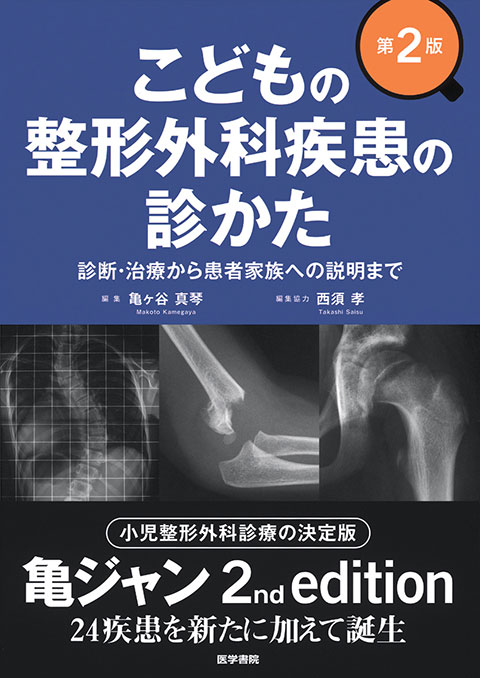 こどもの整形外科疾患の診かた 第2版 | 書籍詳細 | 書籍 | 医学書院