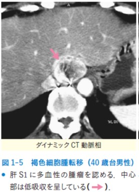 図1-5.jpg