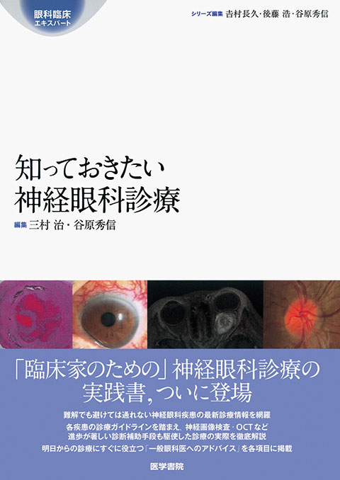 知っておきたい神経眼科診療