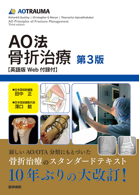 AO法骨折治療［英語版Web付録付］　第3版