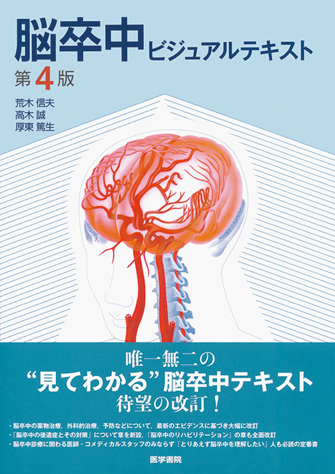 脳卒中ビジュアルテキスト　第4版