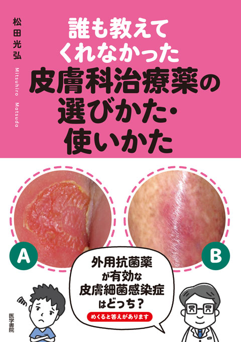 誰も教えてくれなかった皮膚科治療薬の選びかた・使いかた