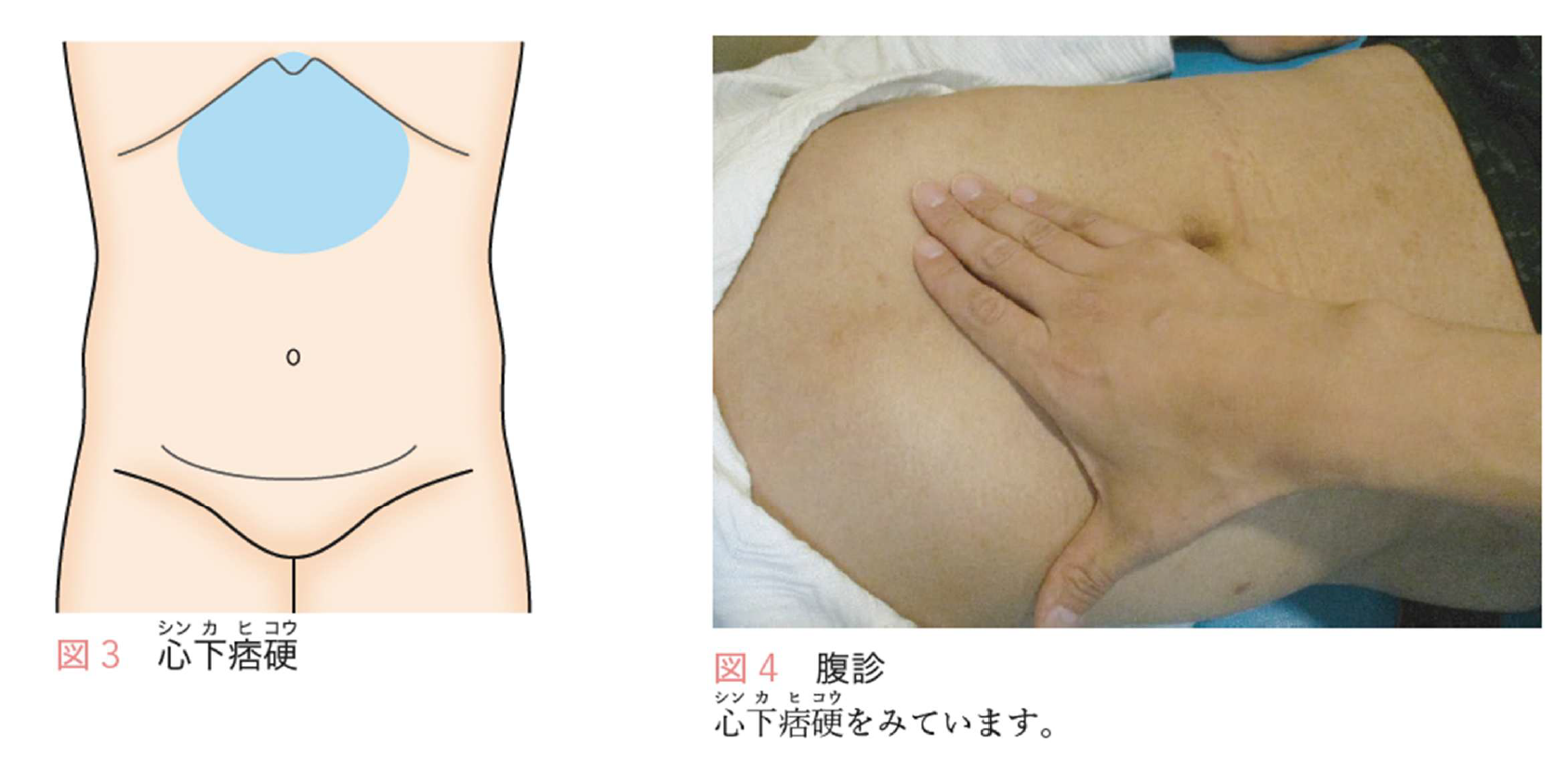 スクリーンショット 2025-04-07 131906.png