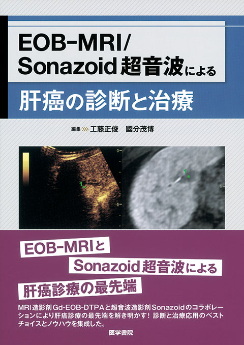 EOB-MRI/Sonazoid 超音波による肝癌の診断と治療