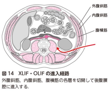 図14.jpg