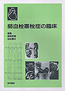 肺血栓塞栓症の臨床