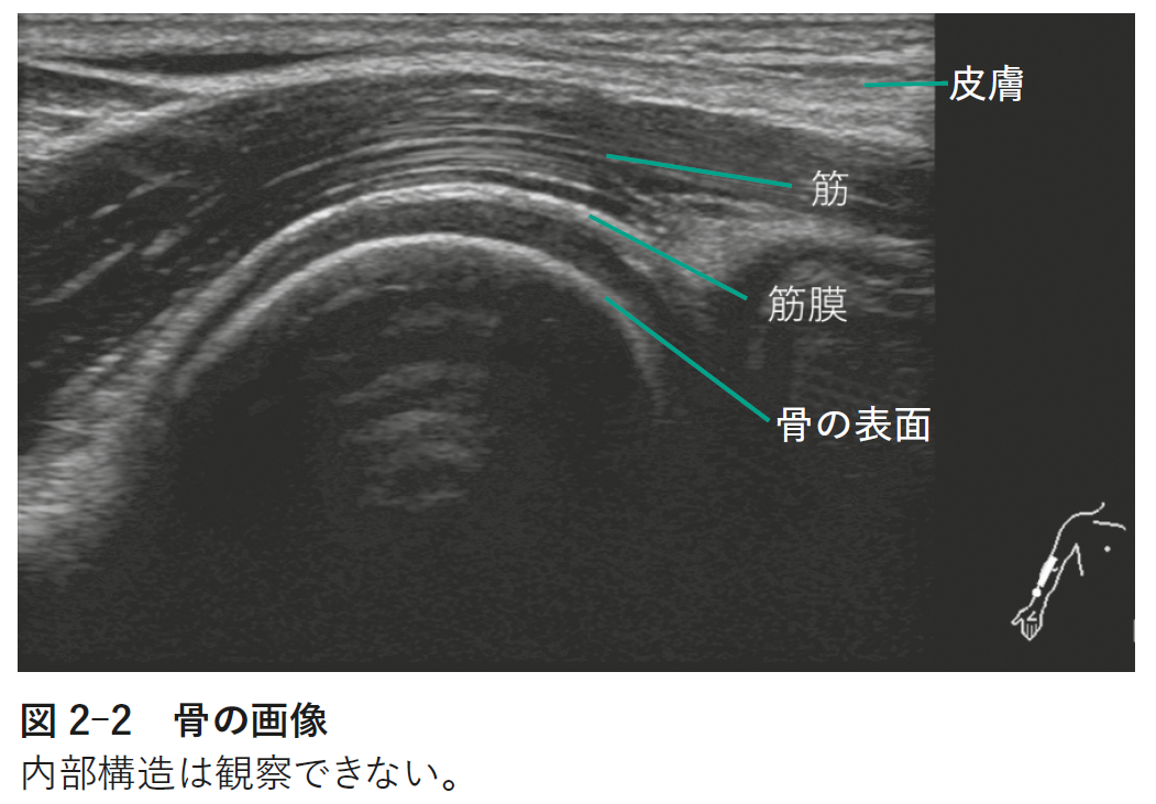 図2-2②.png