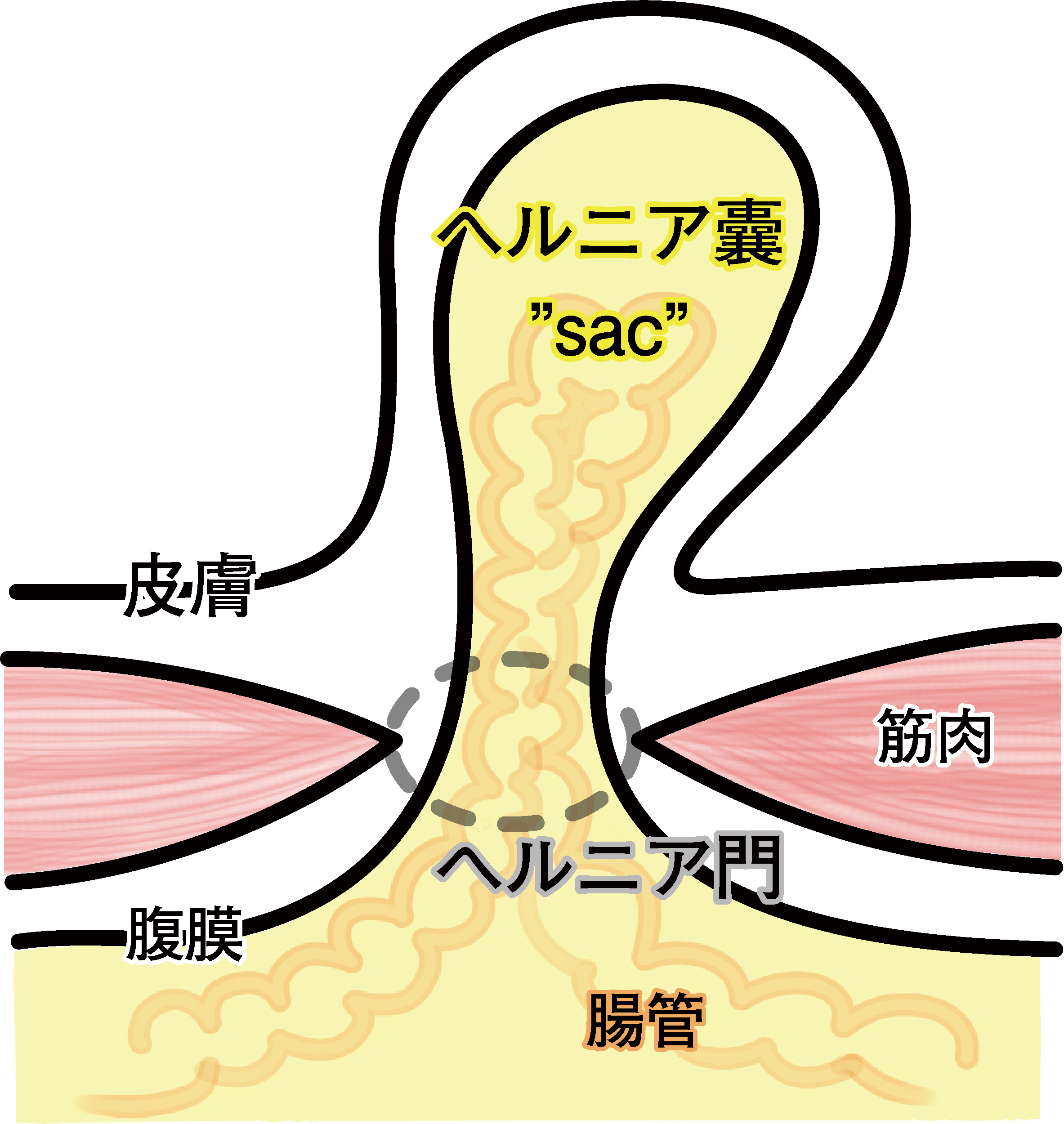 3573号_Web用_図1_2.jpg