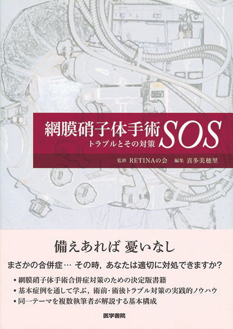 網膜硝子体手術SOS