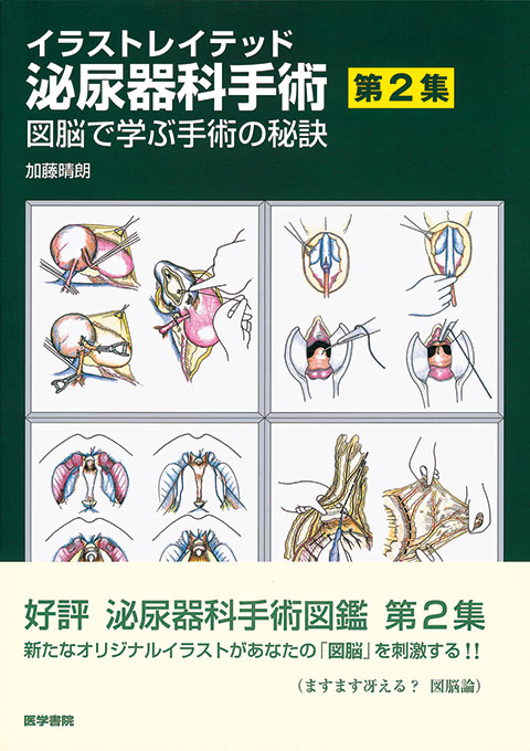 イラストレイテッド泌尿器科手術 第2集 書籍詳細 書籍 医学書院