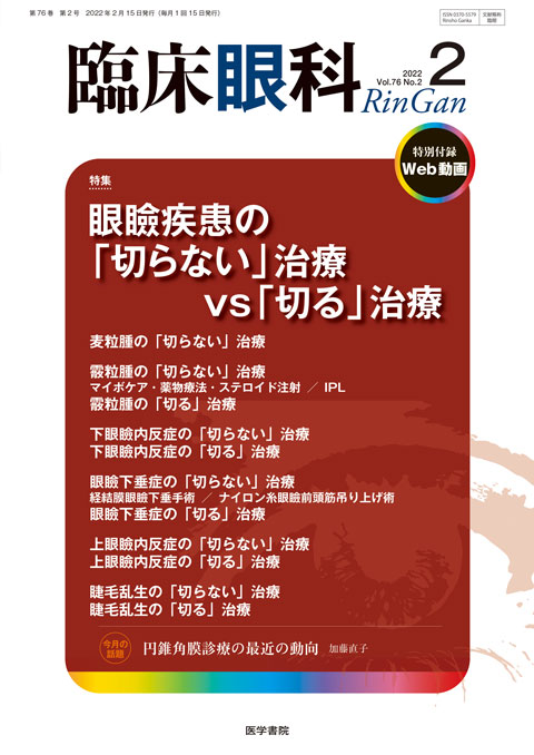 臨床眼科 Vol.76 No.2