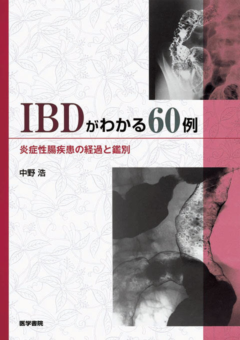 IBDがわかる60例