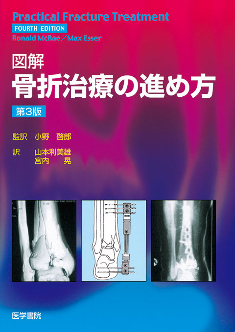 図解 骨折治療の進め方 第3版 書籍詳細 書籍 医学書院