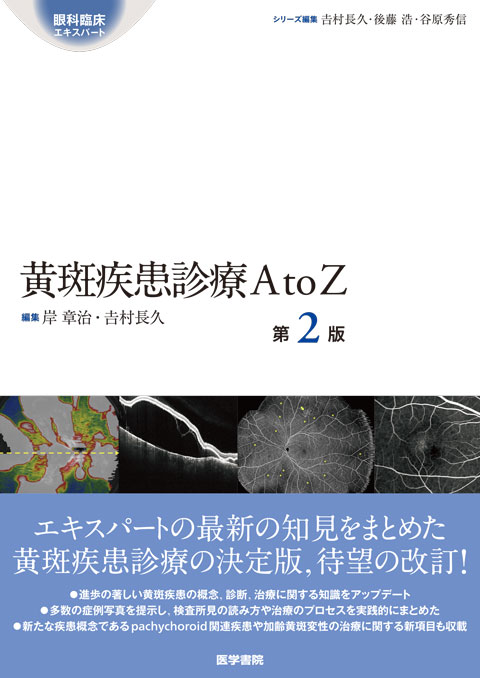 黄斑疾患診療AtoZ　第2版
