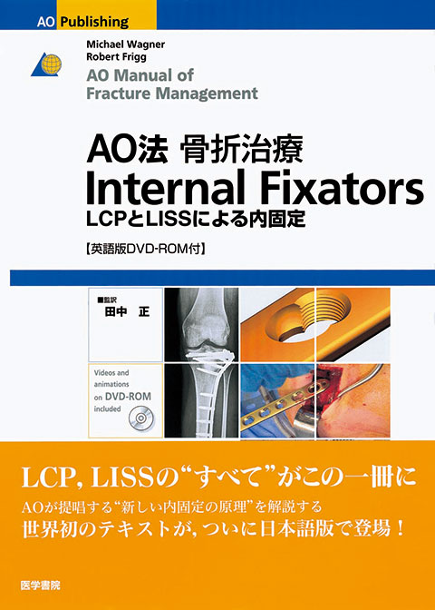 AO法骨折治療　Internal Fixators [英語版DVD-ROM付]