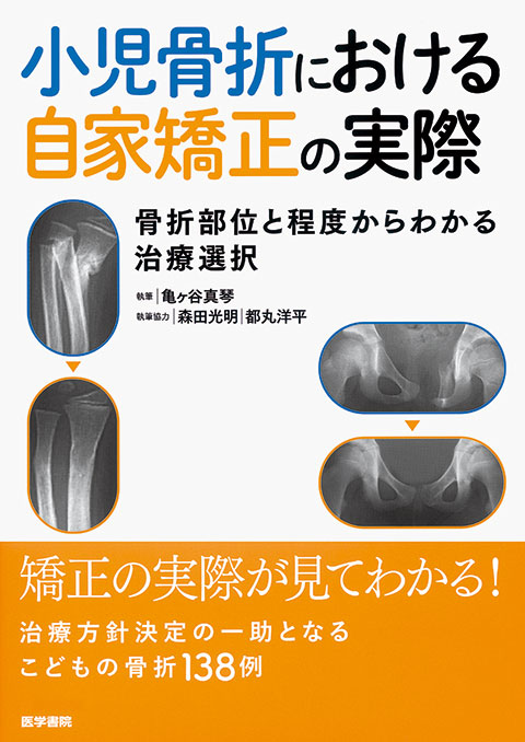 小児骨折における自家矯正の実際 書籍詳細 書籍 医学書院