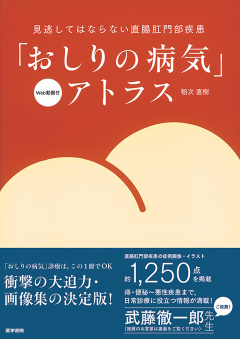 「おしりの病気」アトラス　[Web動画付]