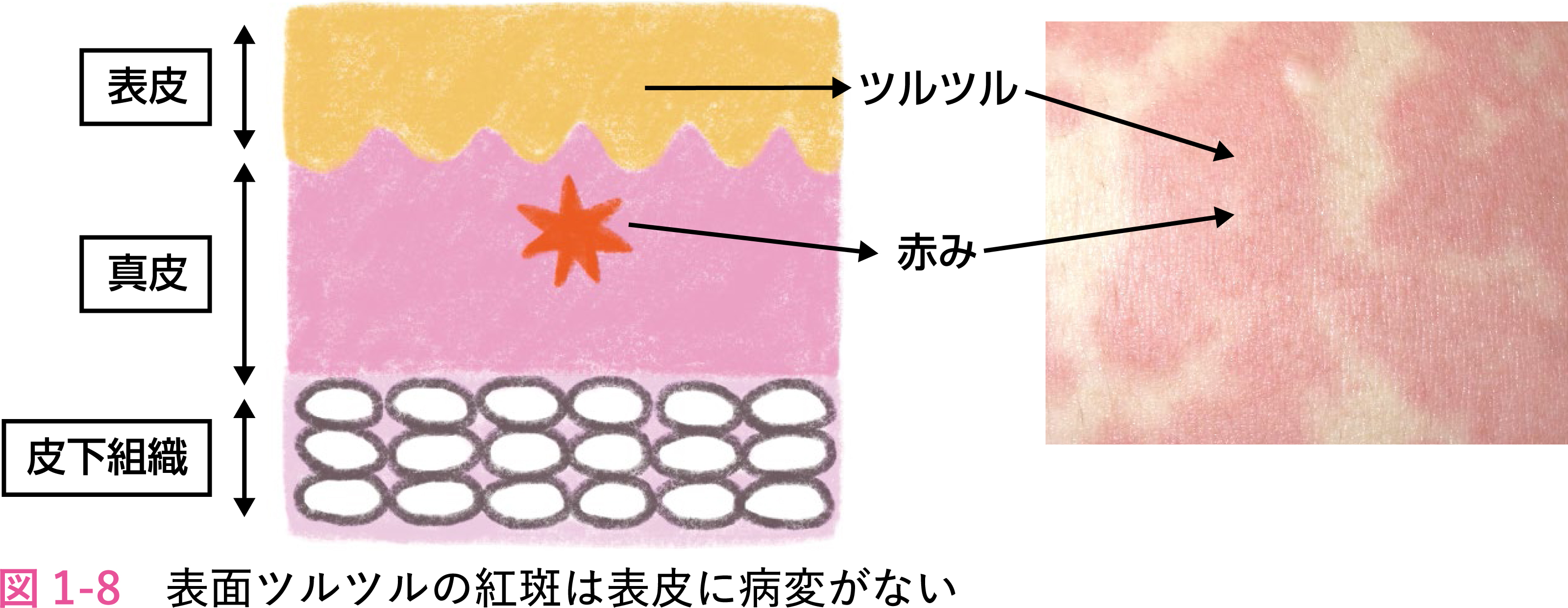 図1-8.jpg