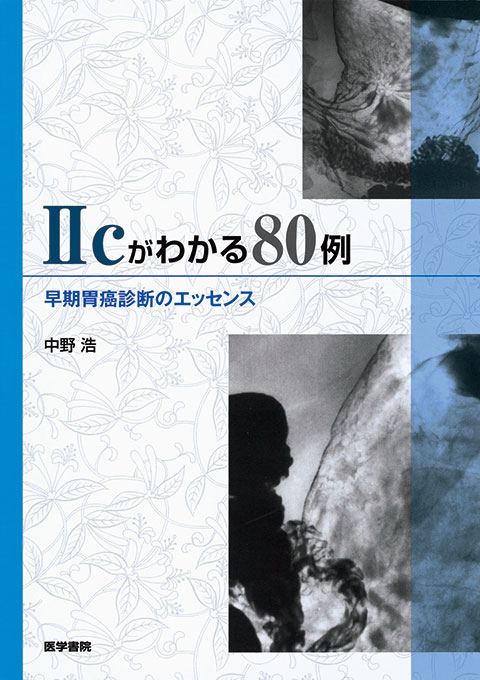 Ⅱcがわかる80例