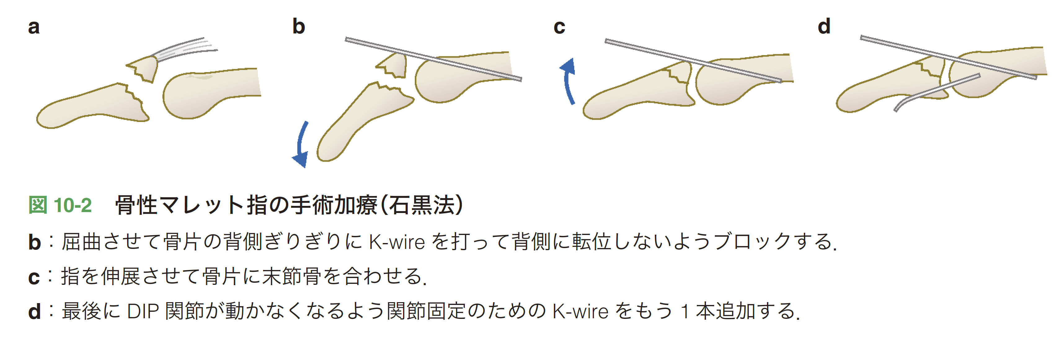 図10-2.png