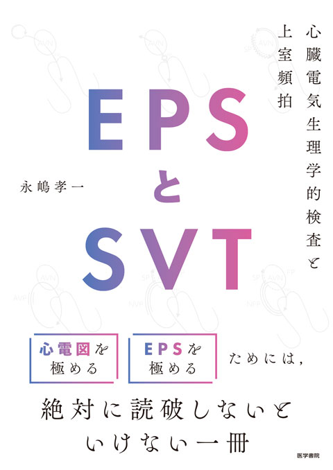 EPSとSVT