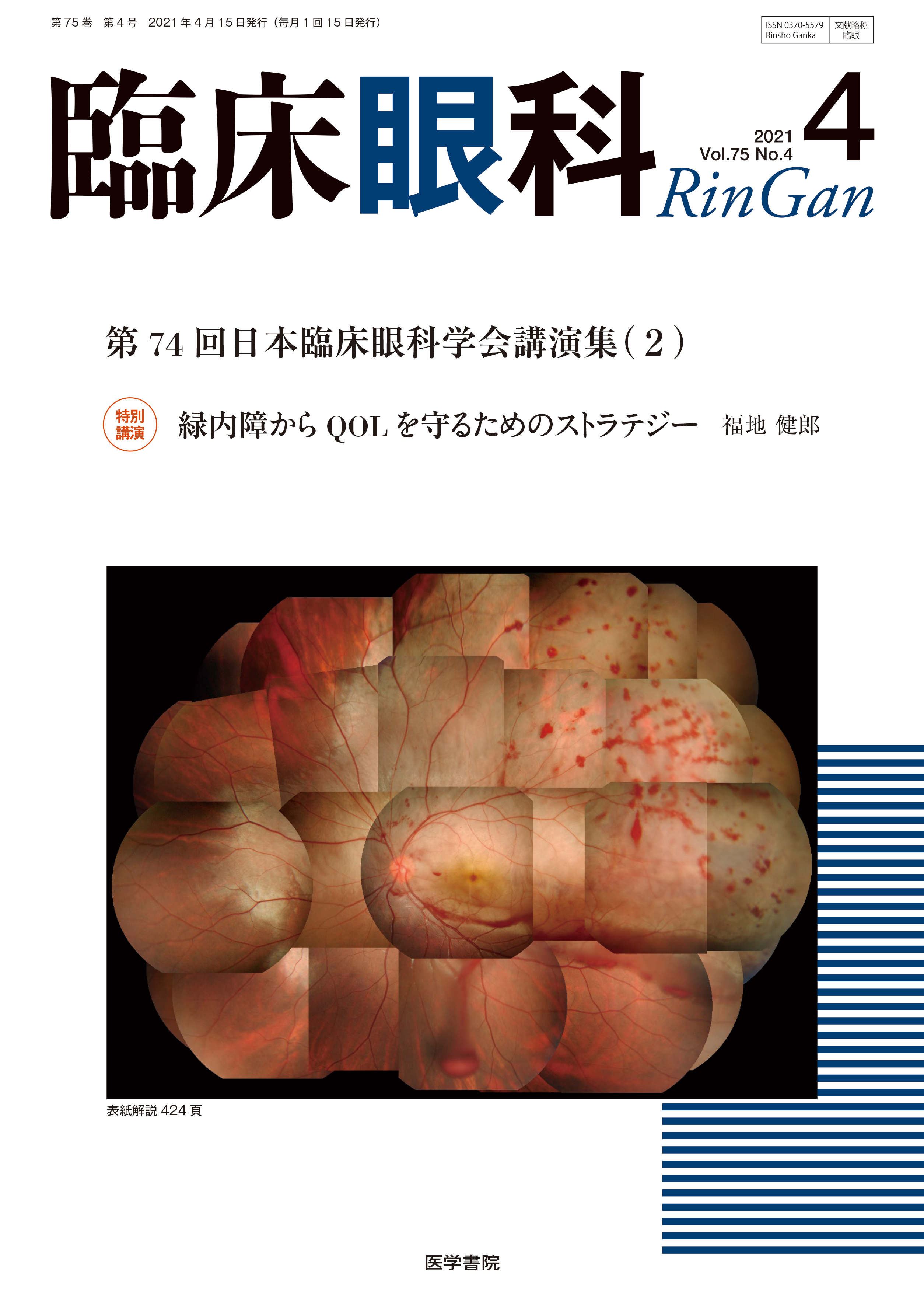 臨床眼科 Vol.75 No.4