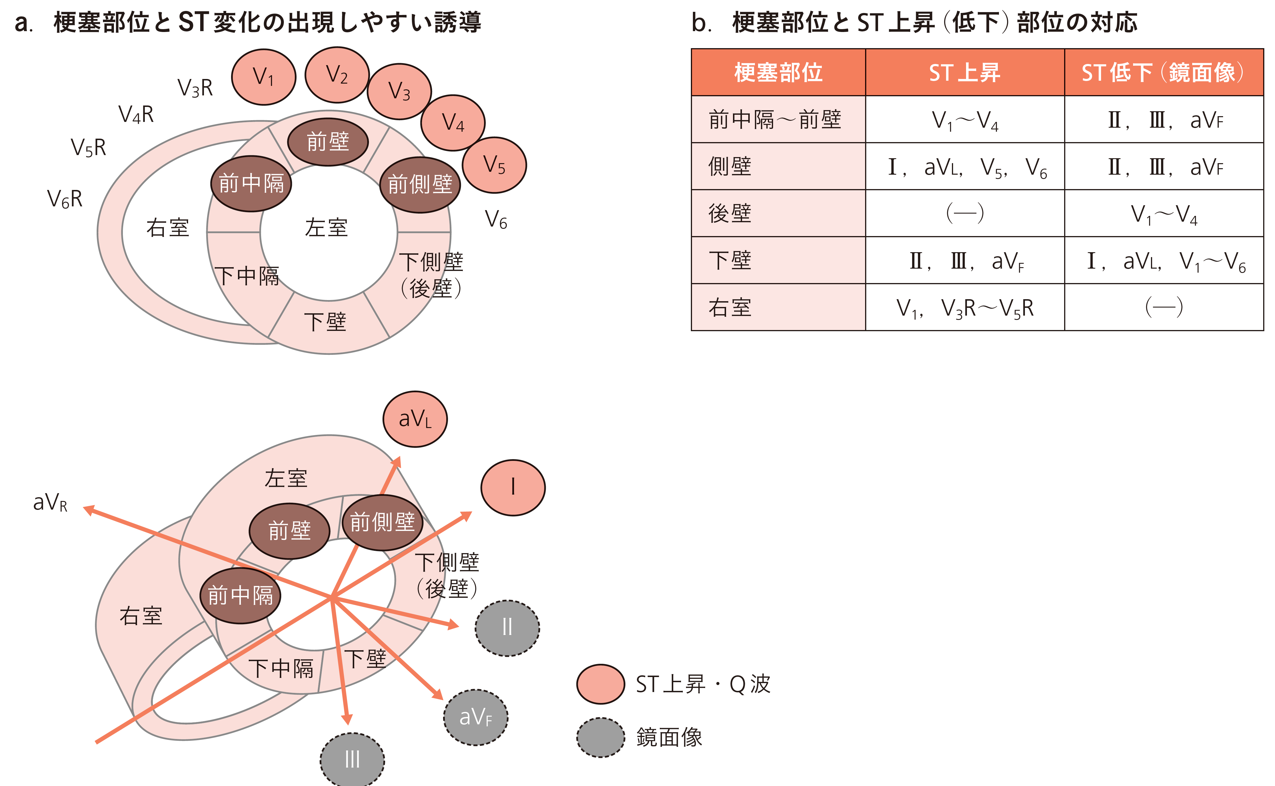 図A　急性心筋梗塞においてST上昇を認める誘導と梗塞部位の関係