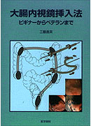 大腸内視鏡挿入法