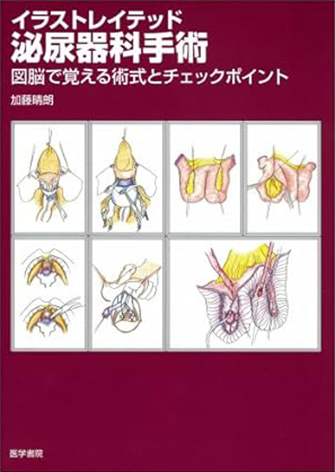 イラストレイテッド泌尿器科手術