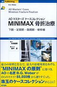 MINIMAX骨折治療