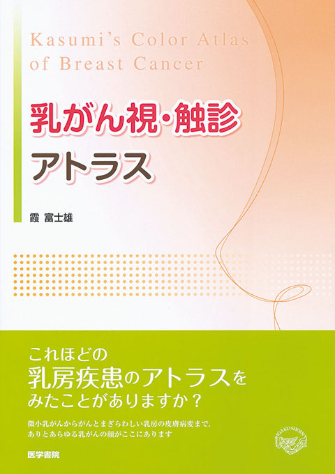 乳がん視・触診アトラス