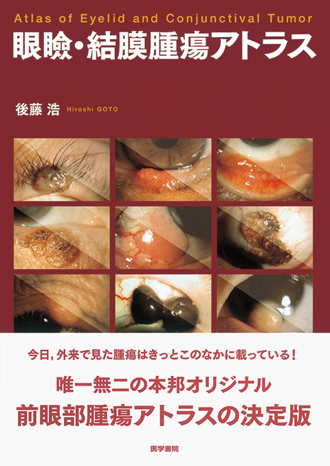 神経眼科学を学ぶ人のために 第3版 | 書籍詳細 | 書籍 | 医学書院