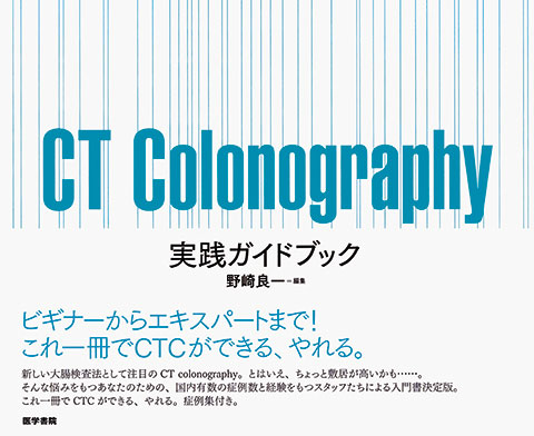 CT Colonography 実践ガイドブック