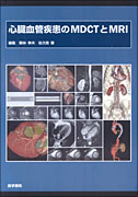 心臓血管疾患のMDCTとMRI