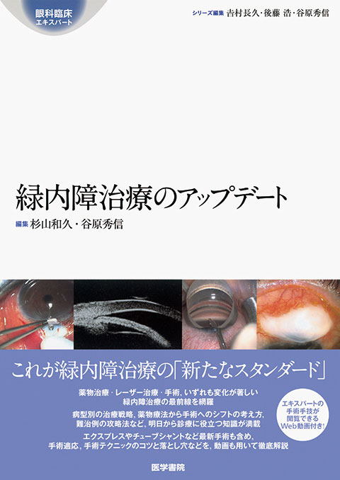 All About 原発閉塞隅角緑内障 | 書籍詳細 | 書籍 | 医学書院