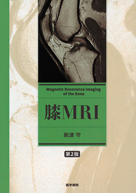 膝MRI　第2版