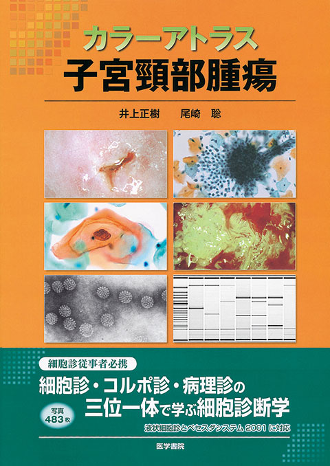 日本製 クリエイティブサイトロジー2 子宮内膜細胞診の臨床的価値と