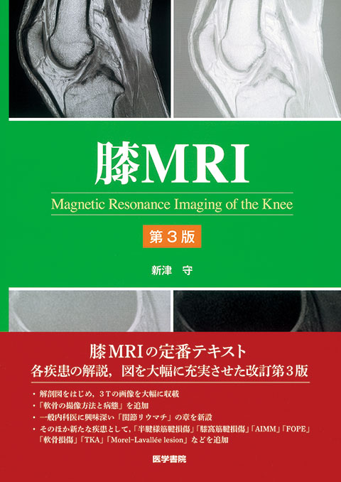 膝MRI　第3版