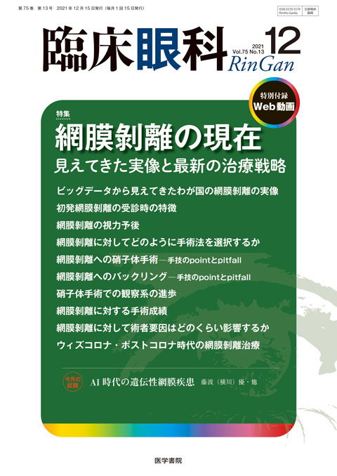 臨床眼科 Vol.75 No.13