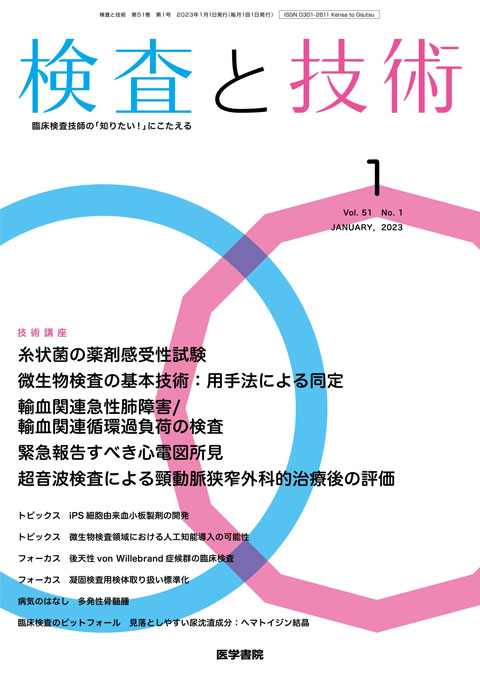 検査と技術 Vol.51 No.1