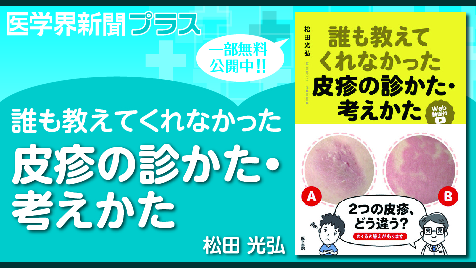 誰も教えてくれなかった皮疹の診かた・考えかた[Web動画付] | 書籍詳細