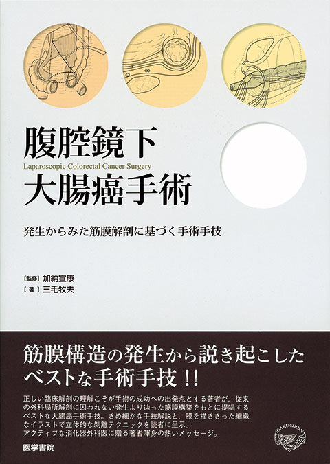 腹腔鏡下大腸癌手術 | 書籍詳細 | 書籍 | 医学書院